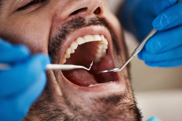 Dentist for Dental Trauma in CA